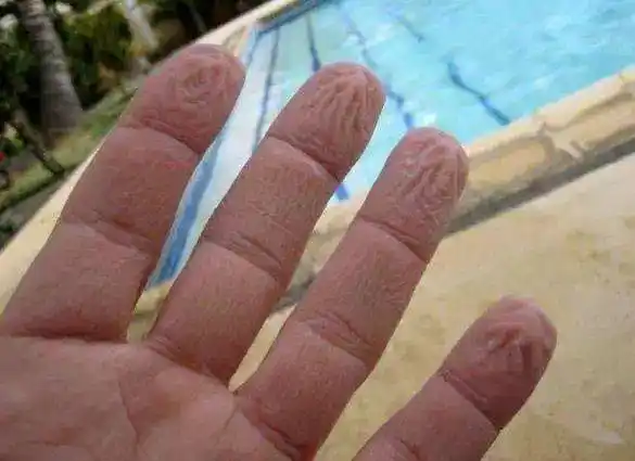 手指褶皱有原因