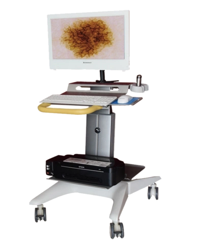 平庄矿区总医院设备简介:皮肤镜