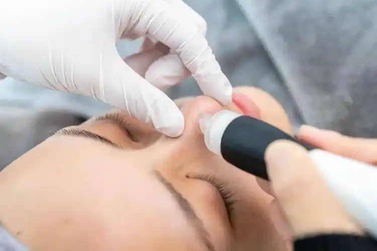 0699抢小气泡护理14折抢殿堂级美容项目冬天变美秘籍被我找到了