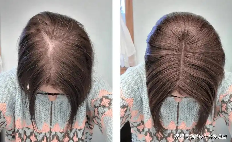 该说不说,这种假发片也太适合发缝宽的女生了吧一般轻微脱发的可以