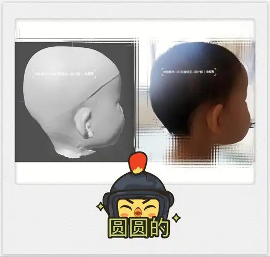 方颅偏头宝宝放福利了