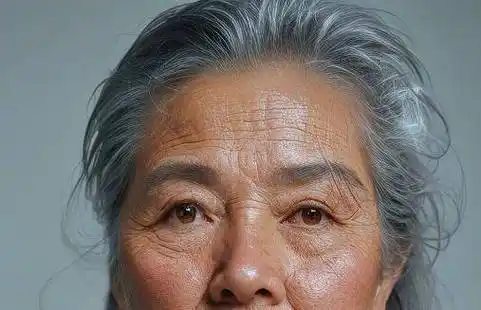 长在前额,两鬓,后脑勺,分别暗示什么_头发_黑色_毛囊