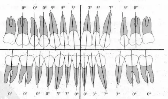 正常排列的牙齿,牙冠的长轴在牙面上的位置有一定的近远中生理倾斜度