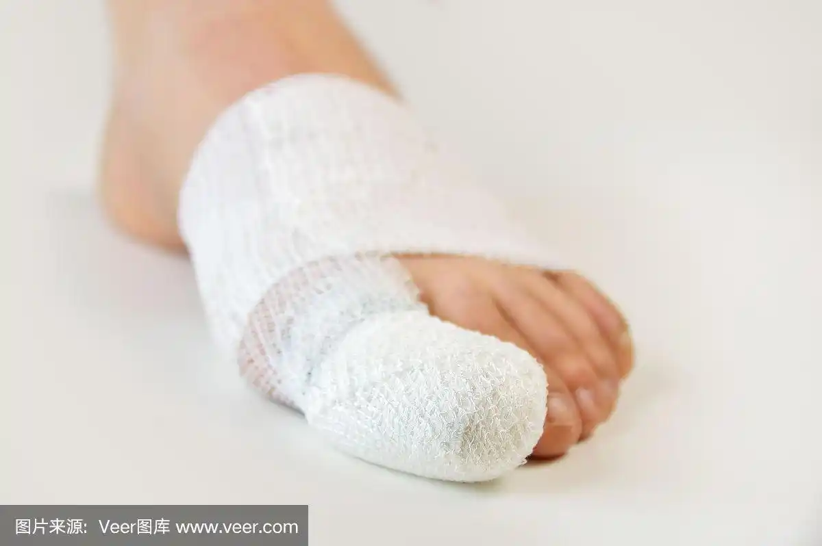 受伤的脚趾用绷带包扎