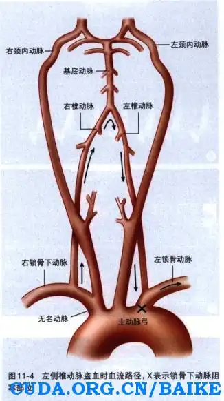 椎动脉的诊断要点