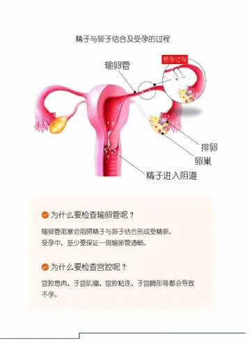 子宫输卵管造影知多少?——郑大一附院王艳丽教授精编版