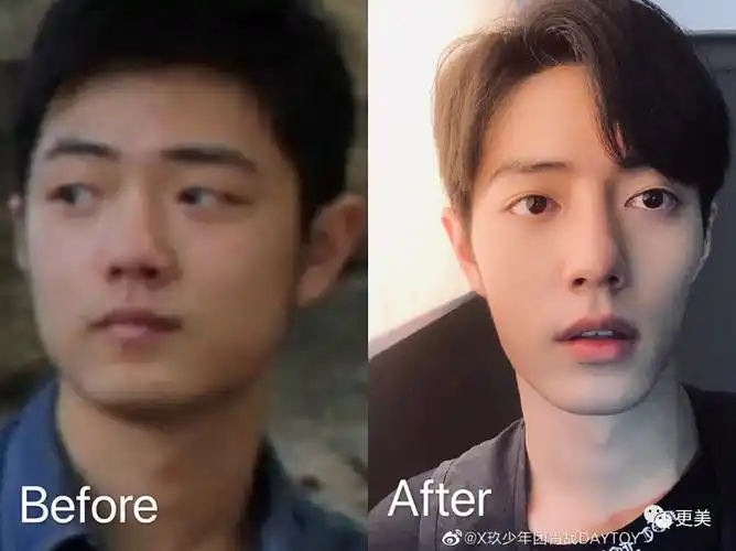 肖战被整形医生石锤换头堪比baby