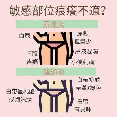你好可能系因为你患上阴道炎或尿道炎.
