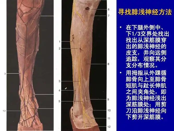 下肢局部解剖学-人体局解剖学-课件-01ppt