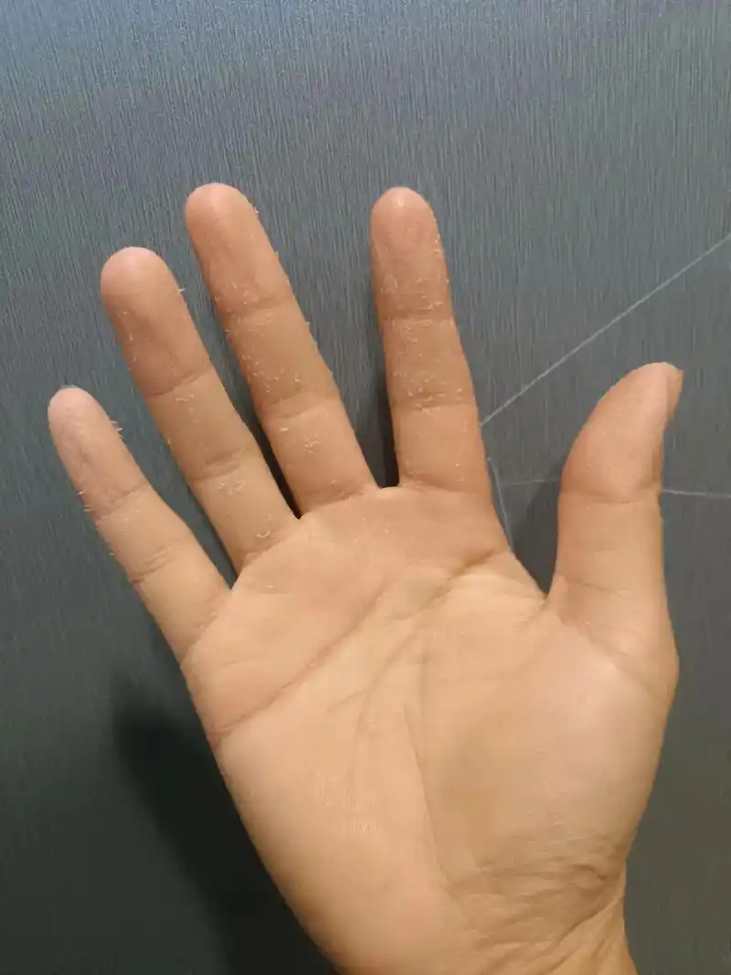 洗碗手#努力拼搏中#搬砖人 #努力的打工人 #生活不会辜负 - 抖音