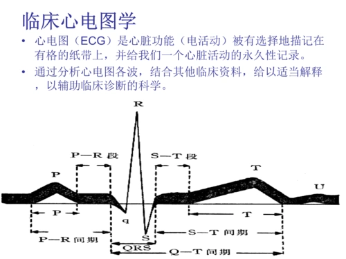 正常及异西常心电图.ppt 41页