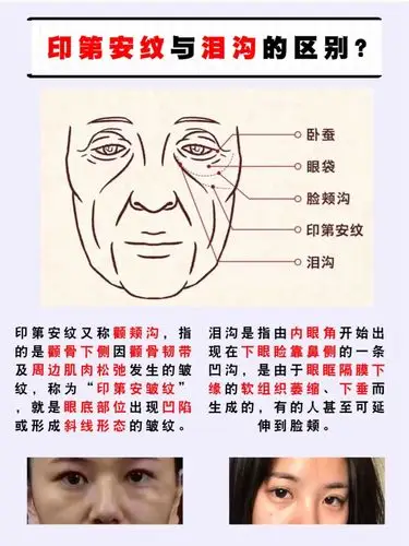 显老的印第安纹你有吗最全解决办法可别以它为美,咱不是明星!