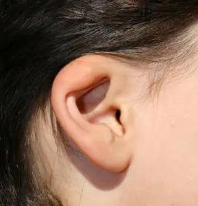 变形的耳朵.耳廓畸形发展.整形外科和美容照片