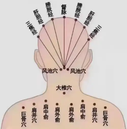 头部环形头痛——脾经不通头两侧痛——胆经不通后脑勺痛——膀胱经不