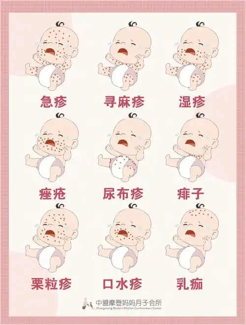 教你一分钟辨别9种宝宝常见皮肤病建议收藏