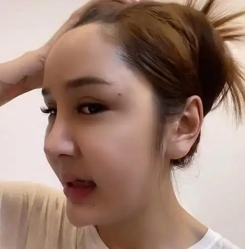 冯提莫整容现状,酷似大妈,鼻子塌,脸还胖,网友差点认不出!