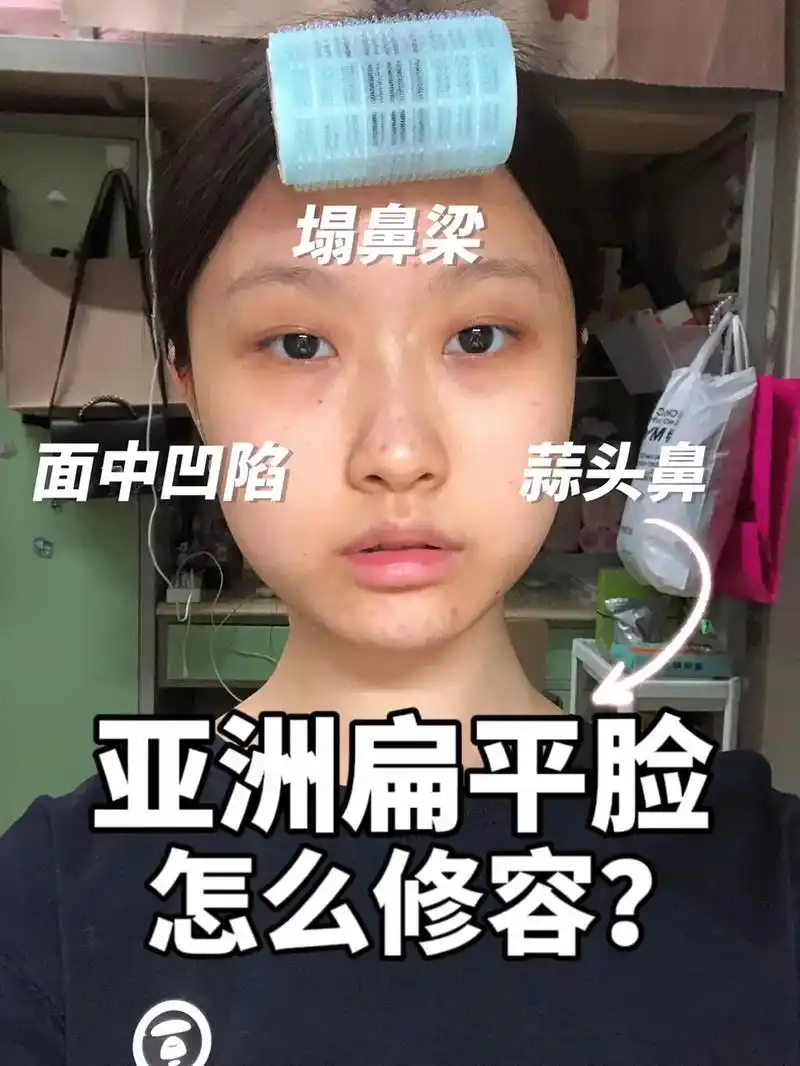 新手保姆级教程之《扁平脸骨相修容大法》78.