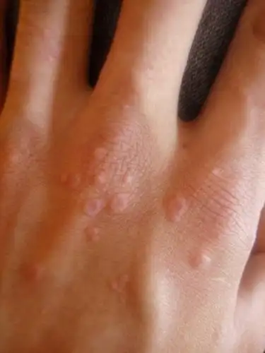 手上和脸上长了这些"疙瘩"?不用苦恼,厨房一物可轻松搞定