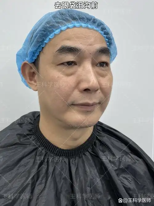 因此感到非常自卑,不自信