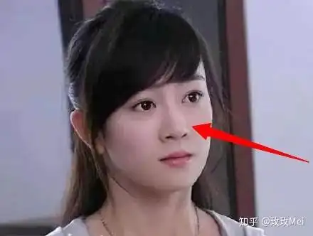 张檬之前的鼻子有点扁平.