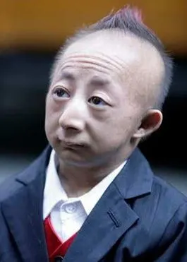 身高73 cm(2尺5吋),曾是吉尼斯世界纪录上世界最矮小的成年人