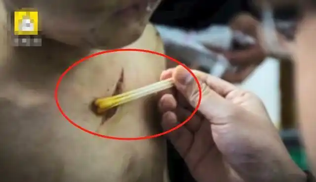 医生反馈他浑身是伤,尤其是胸前有一道很深的刀伤,几经询问下,孩子