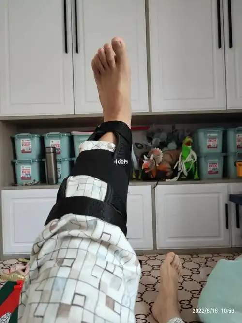 胫骨平台骨折康复记录d59