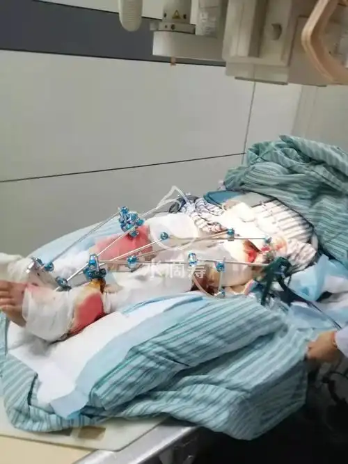 太突然靖江一场严重车祸让这个家庭陷入困境