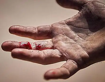 特写,脏,受伤,血,手指