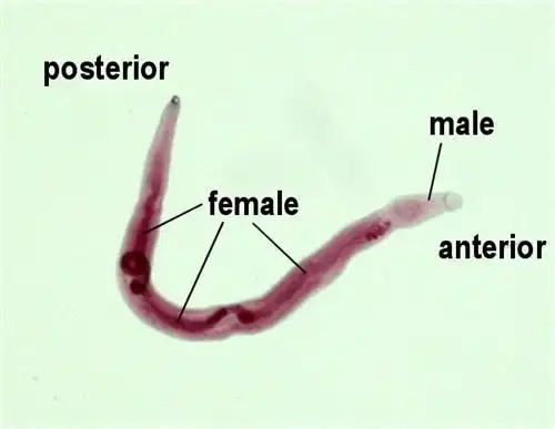 小儿曼氏迭宫绦虫病和曼氏裂头蚴病