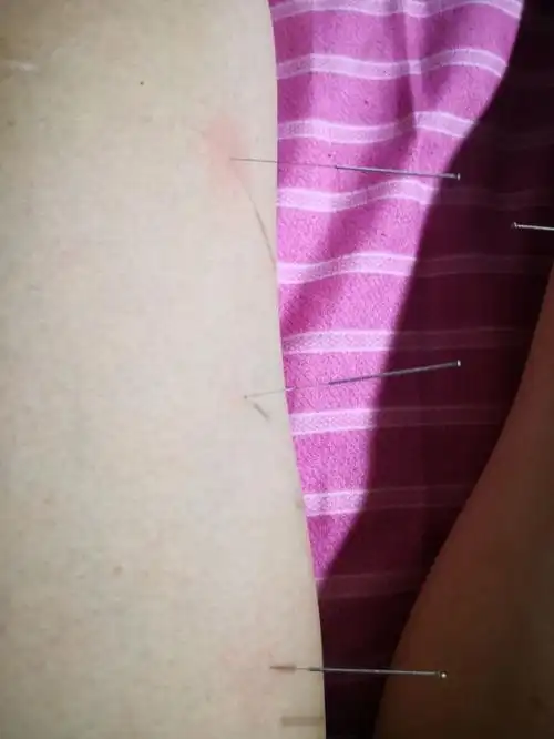 上三黄:治肝必用穴|董氏针灸穴位解读