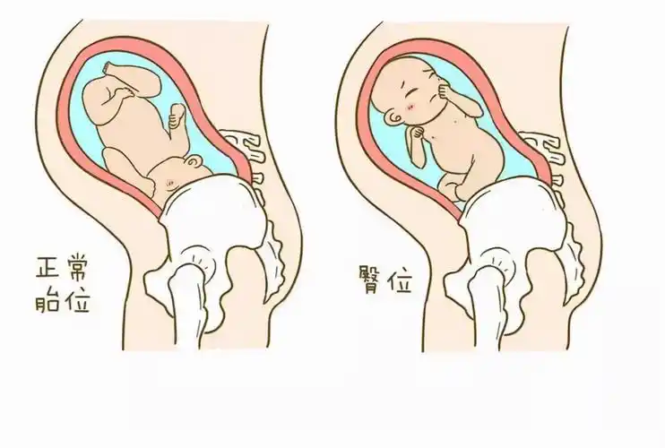 人类女性为何进化出狭窄且扭曲的产道科学家直立行走的代价