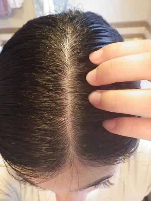 【ljy】健康头皮,发丝交给馥绿德雅