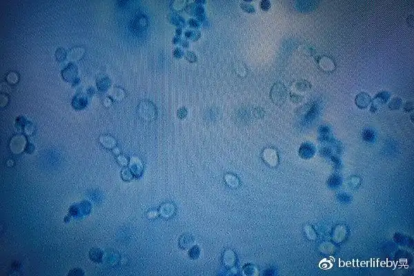显微镜下的耳念珠菌(candida auris)