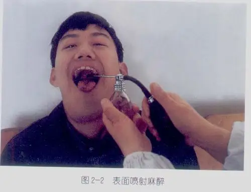 口腔局部麻醉图片