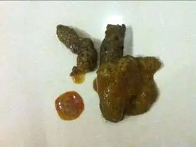 男生拉屎拉出血了是怎么回事,大便突然拉了一滩血怎么回事_竞价网