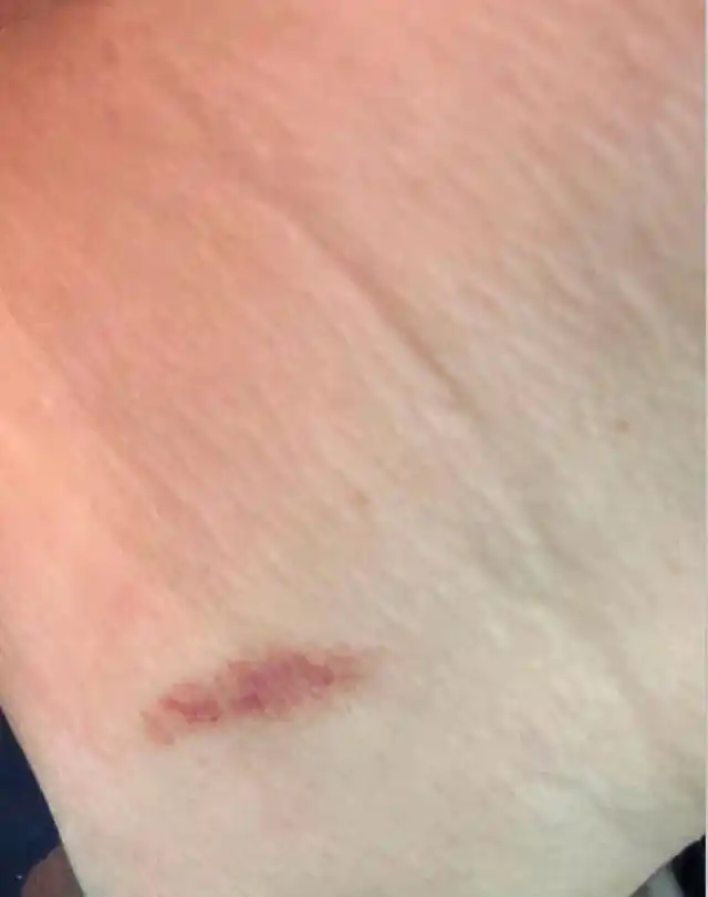 老公出差三天两夜回来,发现吻痕,说是男人掐的,当我傻