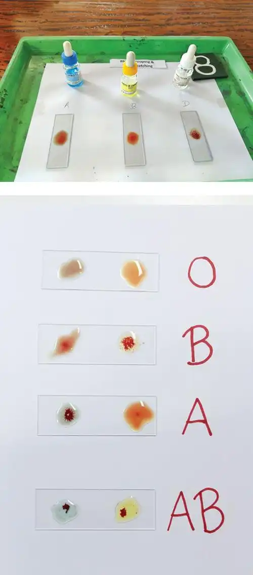 献血是如何检测血型的?