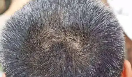 孩子头上的"头旋"个数代表什么?