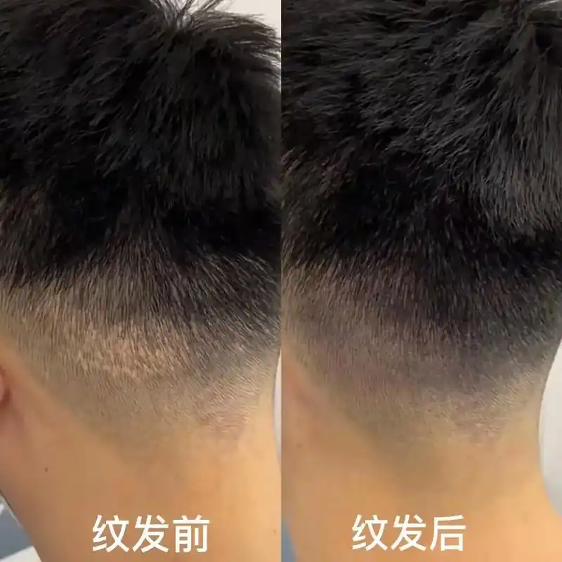 男士smp纹发·头顶稀疏加密 从头顶露白7915浓密蓬松 从头发 - 抖