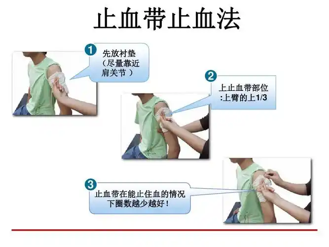 创伤救护(止血,包扎,固定,搬运)ppt