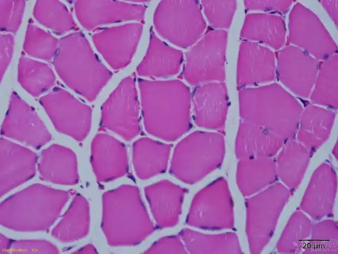 切片厚度是3um,拷片时间为2h,会不会是切片太薄了?骨骼肌组织