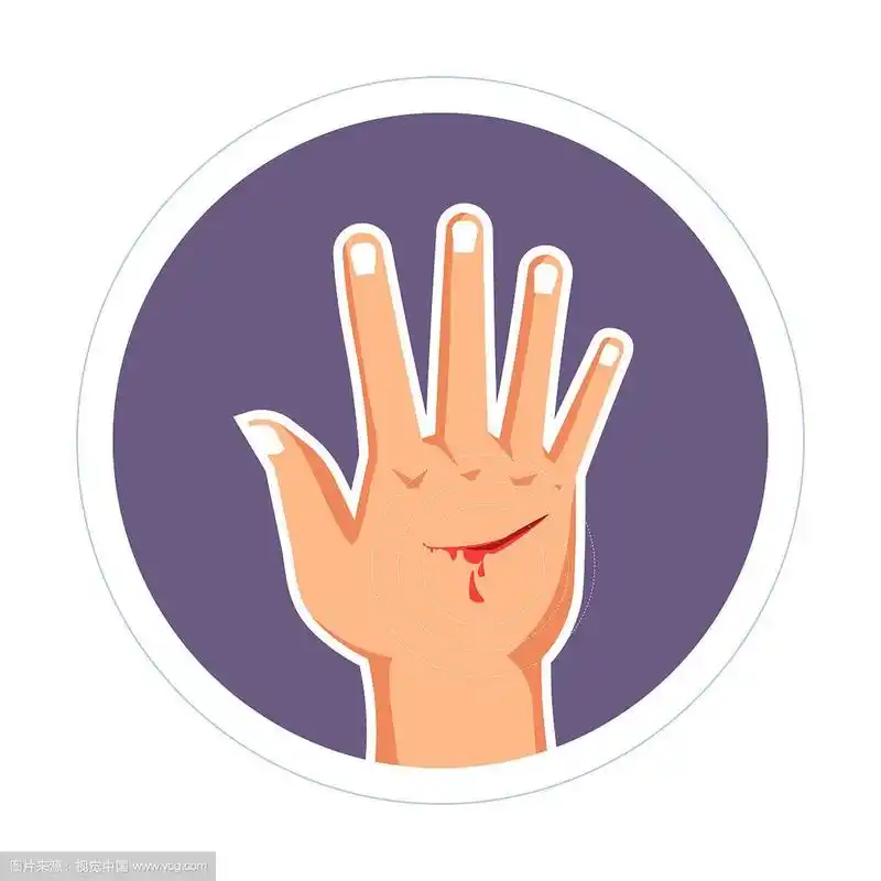 手上的伤口出血擦伤皮肤损伤