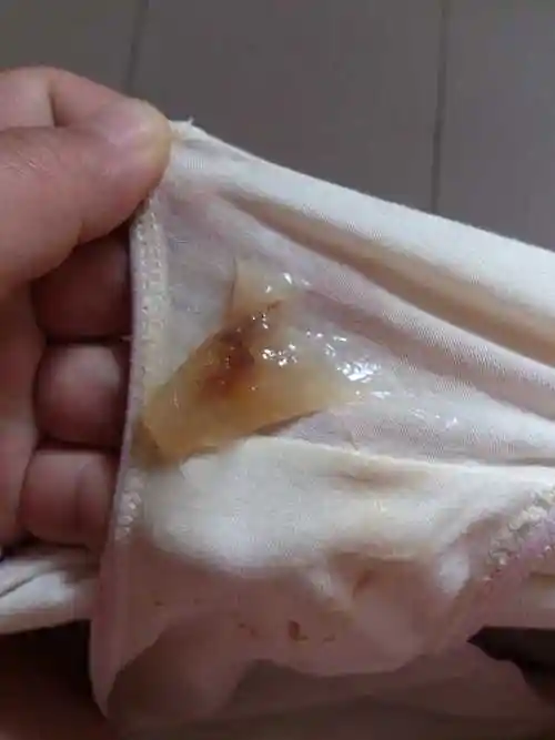 求助!有宝妈们像我这样有很大一坨果冻粘液吗