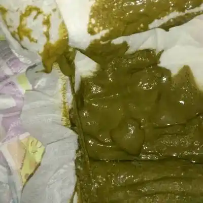 我家宝宝三个月了,便便一直都不正常,要麼是黄绿色,要麼就是墨绿色,还