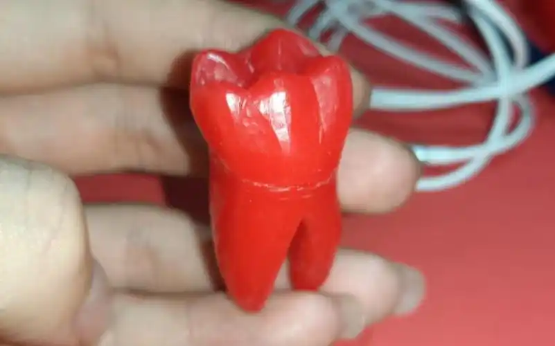 雕牙讲解右下颌第一磨牙有个小错误大家看置顶评论有提出