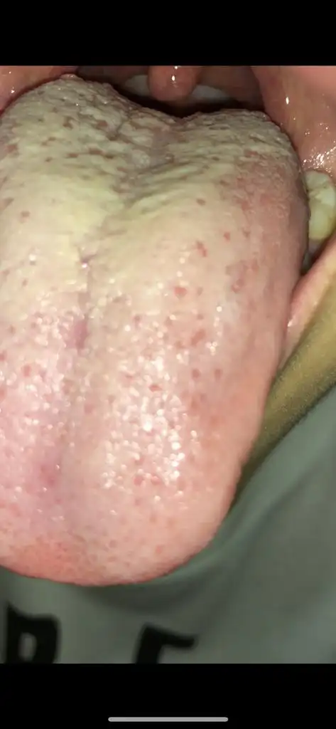 舌头什么是什么