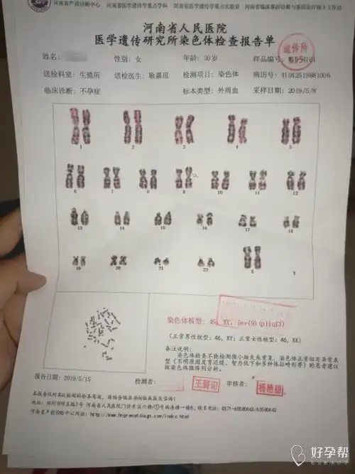 有姐妹染色体检查异常的吗?