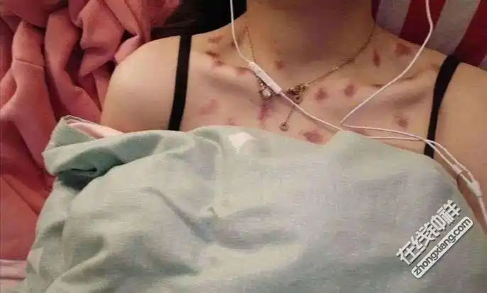看看这个女生的锁骨一大片红印子还非说不是吻痕我咋不太信呢