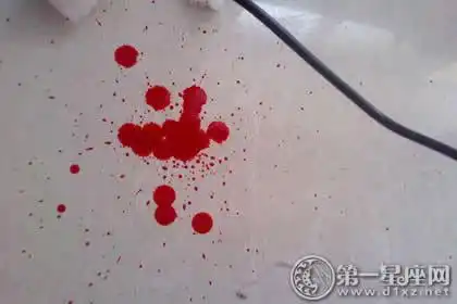 梦见血滴在地上何解?财位在东南方